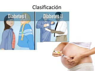 Clasificación