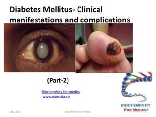 Diabetes Mellitus- Clinical
manifestations and complications

(Part-2)
Biochemistry for medics
www.namrata.co

11/2/2013

Biochemistry for medics

1

 