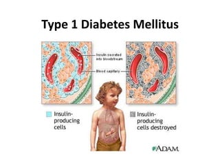 Type 1 Diabetes Mellitus
 