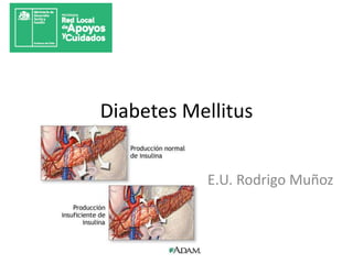 Diabetes Mellitus
E.U. Rodrigo Muñoz
 