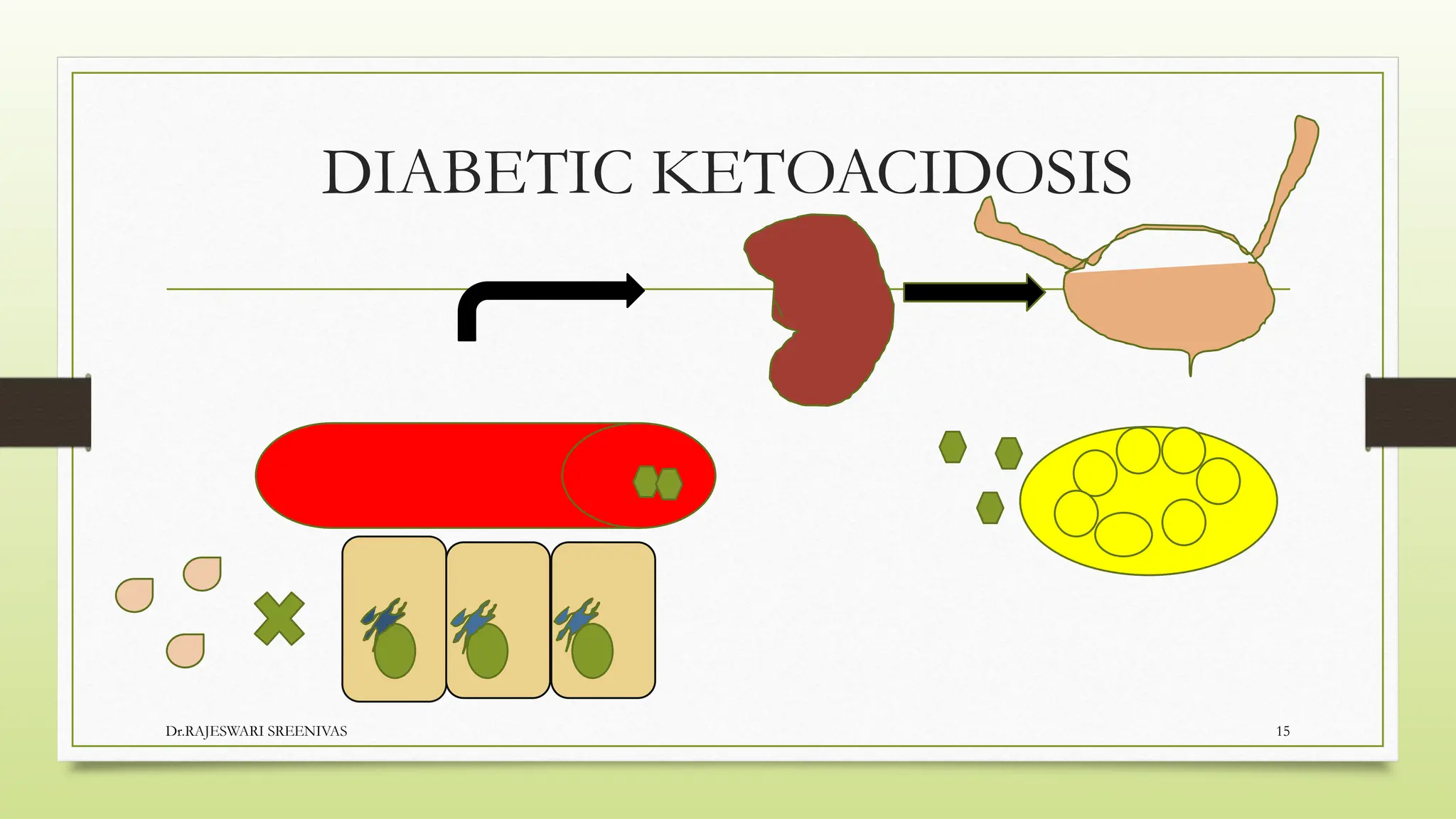 DIABETES MELLITU- types and mechanism of action | PPTX