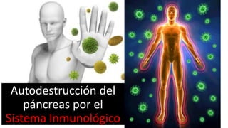 Autodestrucción del
páncreas por el
Sistema Inmunológico
 
