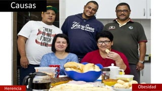 Causas
Herencia Obesidad
 