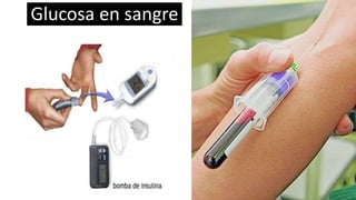 Glucosa en sangre
 