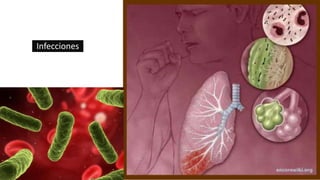 Infecciones
 