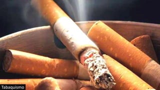 Tabaquismo
 