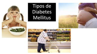 Tipos de
Diabetes
Mellitus
 