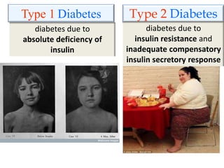 Type 1 Diabetes Type 2 Diabetes
diabetes due to
insulin resistance and
inadequate compensatory
insulin secretory response
diabetes due to
absolute deficiency of
insulin
 