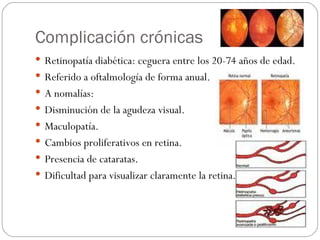Complicación crónicas Retinopatía diabética: ceguera entre los 20-74 años de edad. Referido a oftalmología de forma anual. A nomalías: Disminución de la agudeza visual. Maculopatía. Cambios proliferativos en retina. Presencia de cataratas. Dificultad para visualizar claramente la retina. 