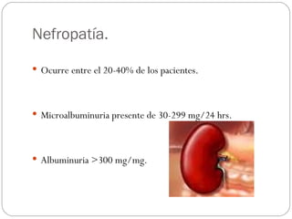 Nefropatía. Ocurre entre el 20-40% de los pacientes. Microalbuminuria presente de 30-299 mg/24 hrs. Albuminuria >300 mg/mg. 