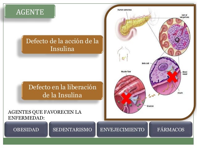 Diabetes mellitus 2. historia natural de la enfermedad Diabetes mellitus 2. historia natural de la enfermedad