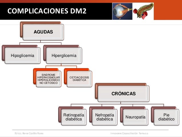 Diabetes mellitus 2 complicaciones otec innovares Diabetes mellitus 2 complicaciones otec innovares