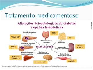 Tratamento medicamentoso
 