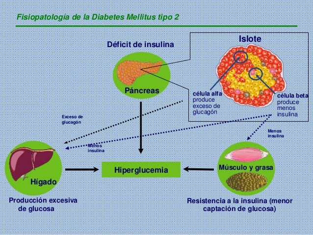 Diabetes mellitus Diabetes mellitus