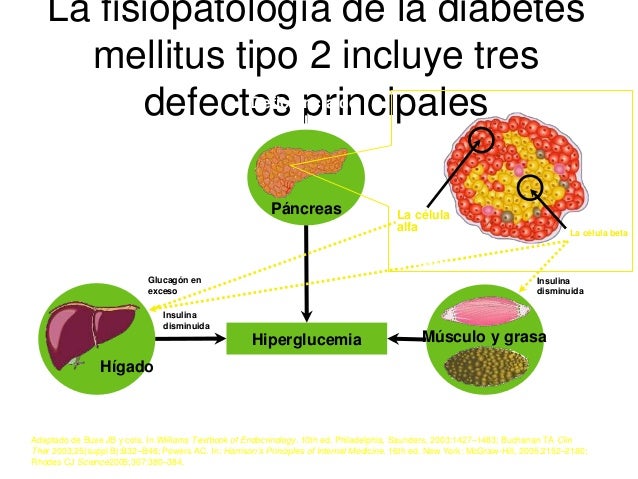 Diabetes mellitus capacitacion asmet educadores Diabetes mellitus capacitacion asmet educadores
