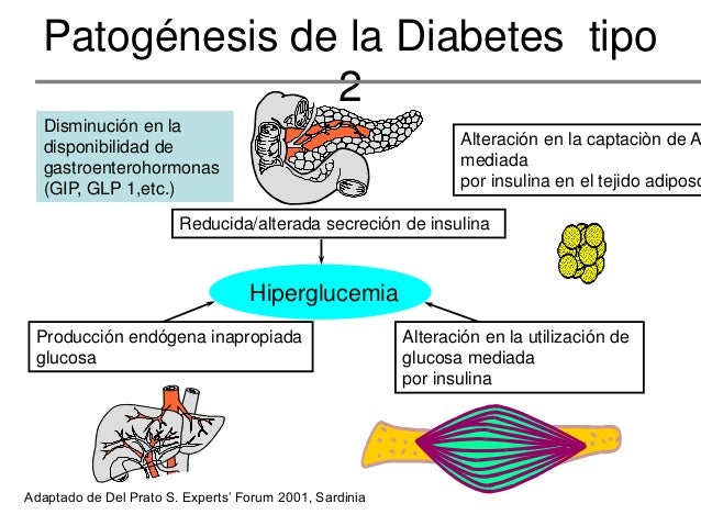 Diabetes mellitus capacitacion asmet educadores Diabetes mellitus capacitacion asmet educadores