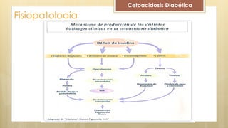 Fisiopatología
Cetoacidosis Diabética
 