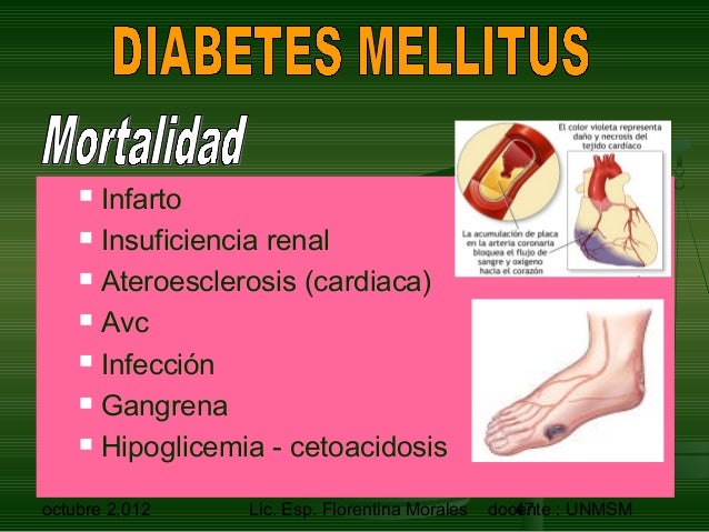 Diabetes mellitus descompensada unmsm flory Diabetes mellitus descompensada unmsm flory
