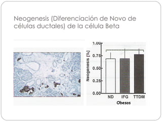 Neogenesis (Diferenciación de Novo de células ductales) de la célula Beta Obesos 