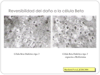 Reversibilidad del daño a la célula Beta Marchetti P et al, JCEM 2004 Célula Beta Diabético tipo 2 Célula Beta Diabético tipo 2  expuesta a Metformina 