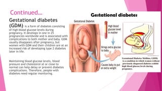 Continued…
Gestational diabetes
(GDM) is a form of diabetes consisting
of high blood glucose levels during
pregnancy. It develops in one in 25
pregnancies worldwide and is associated with
complications to both mother and baby. GDM
usually disappears after pregnancy, but
women with GDM and their children are at an
increased risk of developing type 2 diabetes
later in life.
Maintaining blood glucose levels, blood
pressure and cholesterol at or close to
normal can help delay or prevent diabetes
complications. Therefore, people with
diabetes need regular monitoring.
 