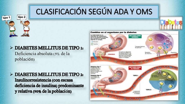 Diabetes mellitus,hipoglucemiantes orales Diabetes mellitus,hipoglucemiantes orales