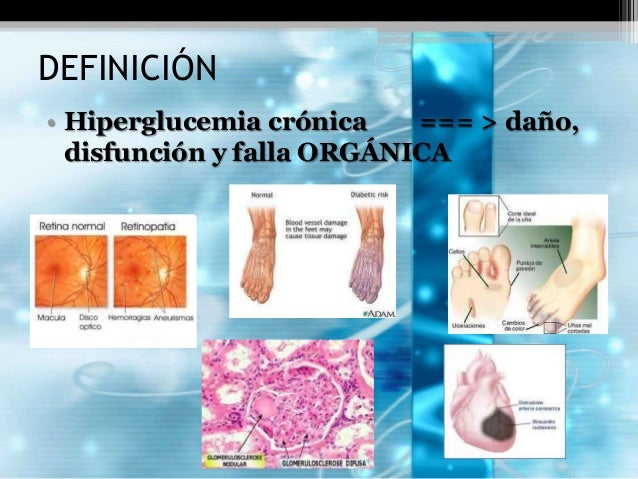 Diabetes mellitus Diabetes mellitus