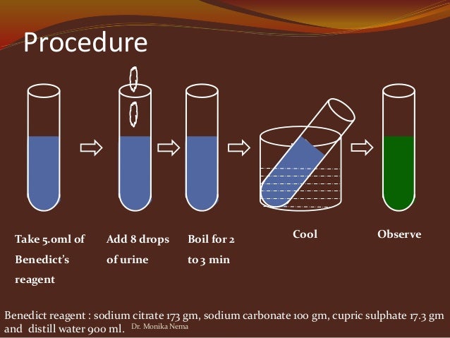 173 glucose blood test Diabetes of Laboratory mellitus diagnosis 173 glucose blood test Diabetes of Laboratory mellitus diagnosis