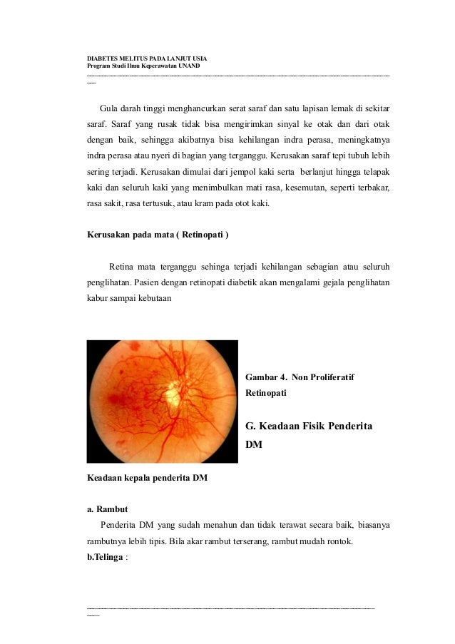 Gejala Diabetes Melitus Tipe 2 Jarang Disadari Dan Bisa Gejala Diabetes Melitus Tipe 2 Jarang Disadari Dan Bisa