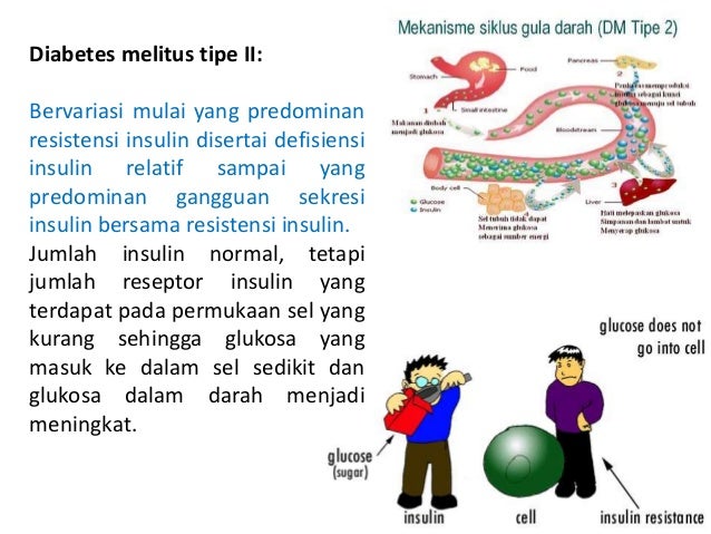 Diabetes Melitus Pada Lansia Diabetes Melitus Pada Lansia
