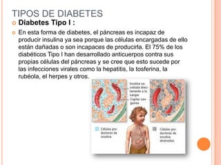 TIPOS DE DIABETES
 Diabetes Tipo I :
 En esta forma de diabetes, el páncreas es incapaz de
producir insulina ya sea porque las células encargadas de ello
están dañadas o son incapaces de producirla. El 75% de los
diabéticos Tipo I han desarrollado anticuerpos contra sus
propias células del páncreas y se cree que esto sucede por
las infecciones virales como la hepatitis, la tosferina, la
rubéola, el herpes y otros.
 