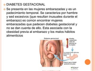  DIABETES GESTACIONAL
 Se presenta en las mujeres embarazadas y es un
padecimiento temporal. Se caracteriza por hambre
y sed excesivos {que resultan inusuales durante el
embarazo) es común encontrar mujeres
embarazadas que padecen diabetes gestacional y
no se dan cuenta de ello. Esta asociada con la
obesidad previa al embarazo y los malos hábitos
alimenticios
 