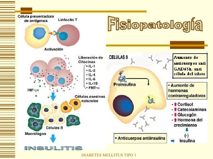 Diabetes Mellitus Tipo 1 Diabetes Mellitus Tipo 1