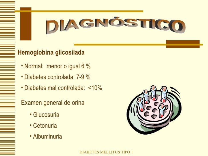Diabetes Mellitus Tipo 1 Diabetes Mellitus Tipo 1