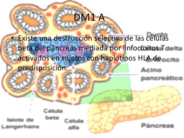 Diabetes mellitus tipo 1 Diabetes mellitus tipo 1