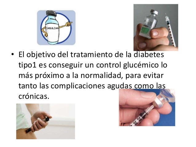 Diabetes mellitus tipo 1 Diabetes mellitus tipo 1