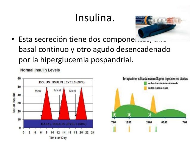 Diabetes mellitus tipo 1 Diabetes mellitus tipo 1
