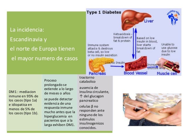Diabetes mellitus tipo 1 Diabetes mellitus tipo 1