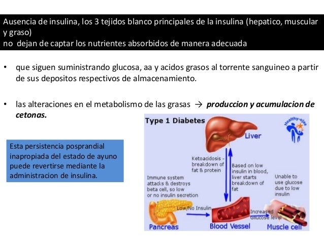 Diabetes mellitus tipo 1 Diabetes mellitus tipo 1