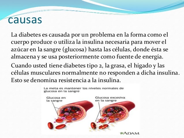 Diabetes mellitus tipo 2 Diabetes mellitus tipo 2