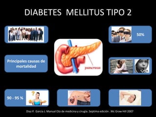 DIABETES MELLITUS TIPO 2
Principales causas de
mortalidad
90 - 95 %
50%
Diaz P. Garcia J. Manual Cto de medicina y cirugía. Septima edición . Mc Graw Hill 2007
 