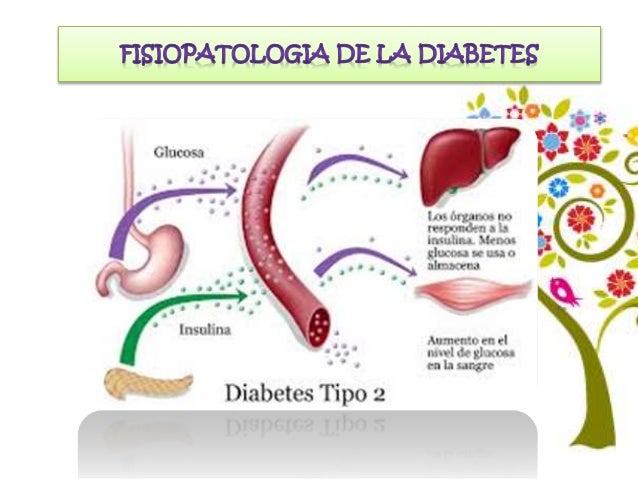 Diabetes mellitus tipo 2 (1) Diabetes mellitus tipo 2 (1)