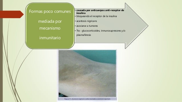 Diabetes mellitus todo Diabetes mellitus todo