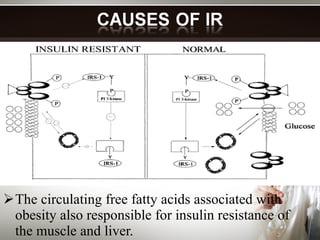 The circulating free fatty acids associated with obesity also responsible for insulin resistance of the muscle and liver. 