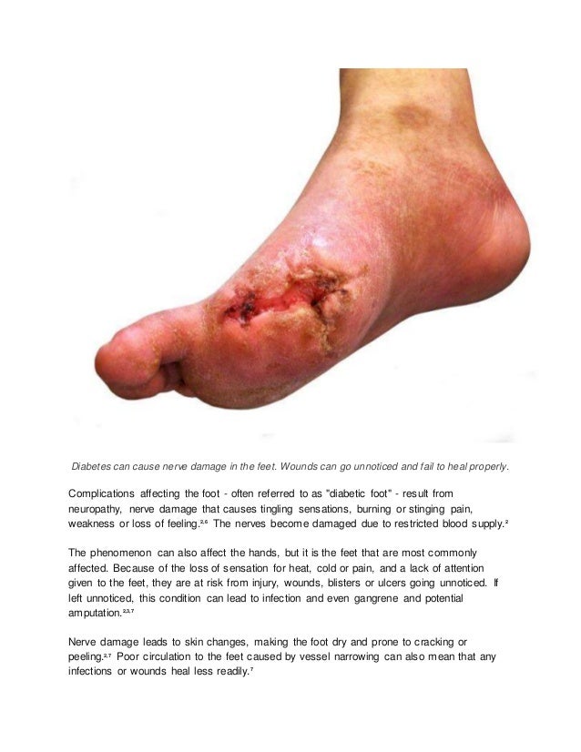Case study diabetes mellitus and chronic renal failure