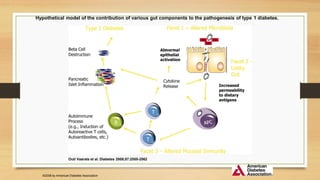 Hypothetical model of the contribution of various gut components to the pathogenesis of type 1 diabetes.
Outi Vaarala et al. Diabetes 2008;57:2555-2562
©2008 by American Diabetes Association
 
