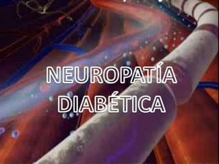 Neuropatía Diabética
 