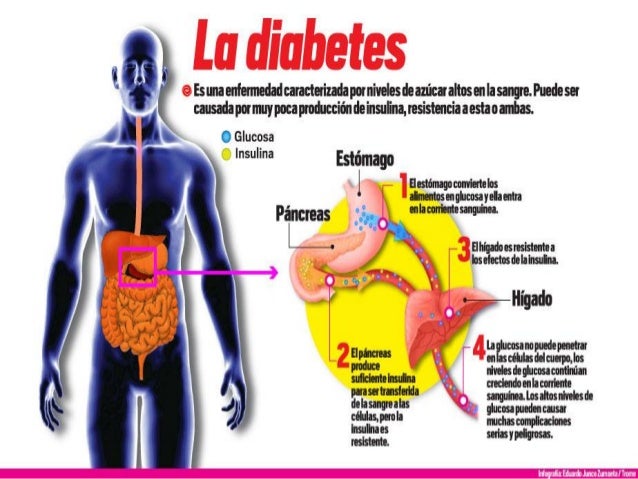 Diabetes no insulinodependiente Diabetes no insulinodependiente