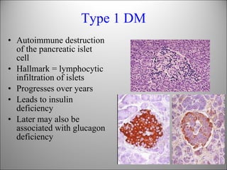 Type 1 DM <ul><li>Autoimmune destruction of the pancreatic islet cell  </li></ul><ul><li>Hallmark = lymphocytic infiltrati...