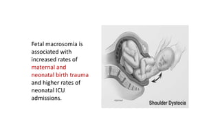 Fetal macrosomia is
associated with
increased rates of
maternal and
neonatal birth trauma
and higher rates of
neonatal ICU
admissions.

 